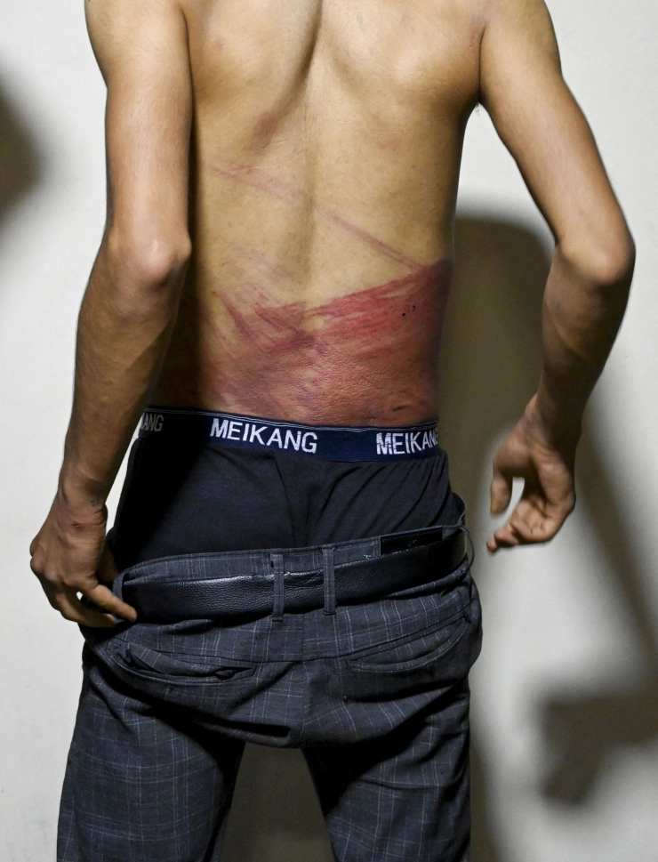 Persvrijheid in Afghanistan op sterven na dood